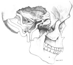 Skull base surgery